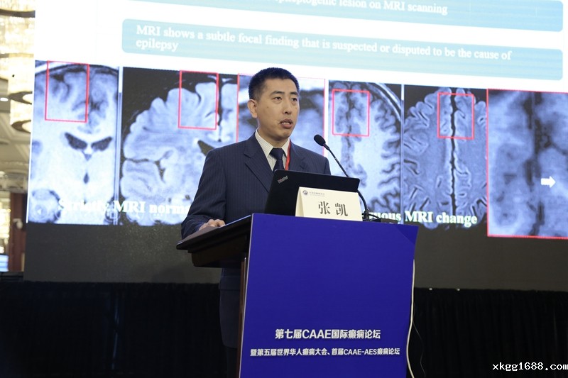 1510213186133389.jpg 0V5A0498.jpg